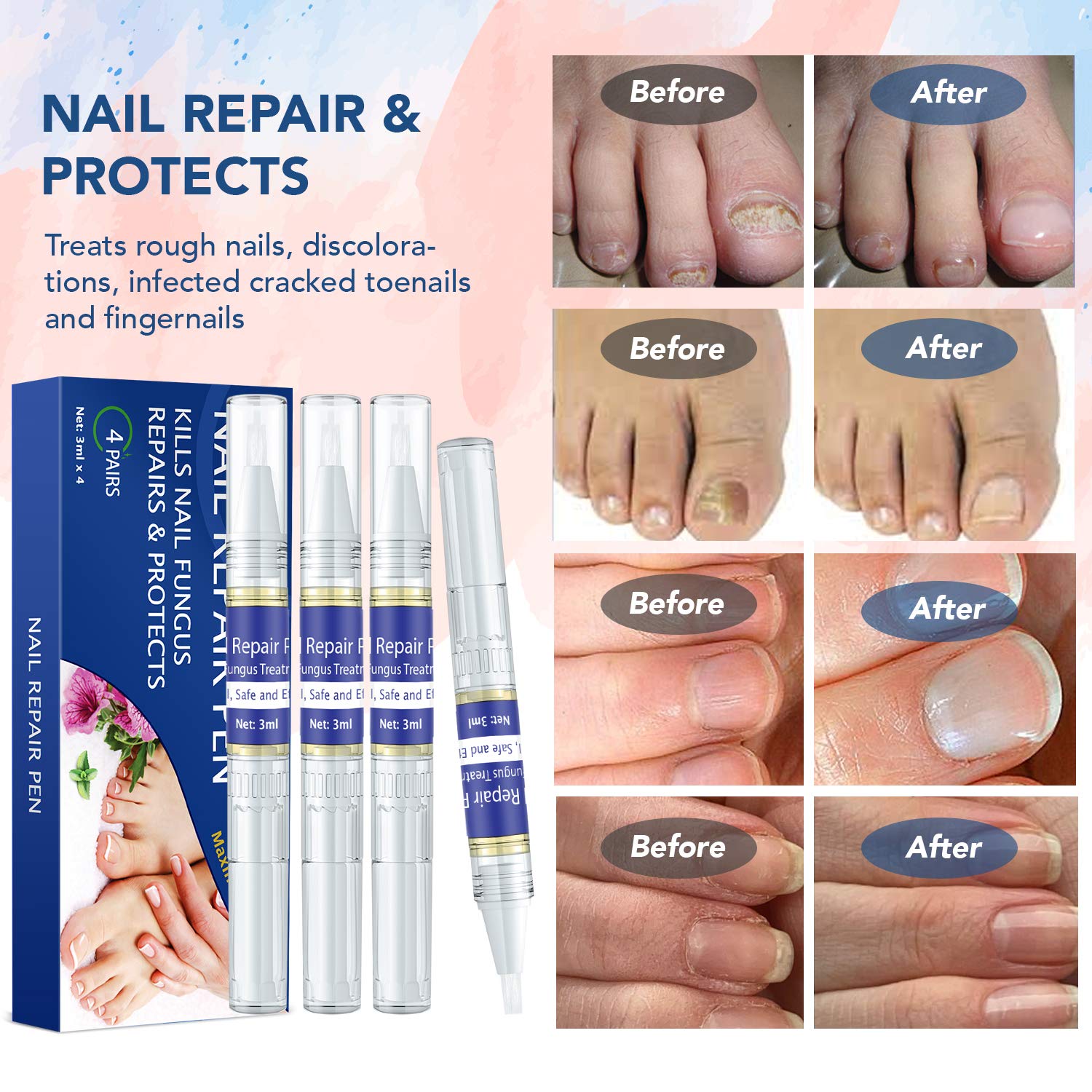 Shop Nail Repair Damage with great discounts and prices online - Sep 2023 |  Lazada Philippines
